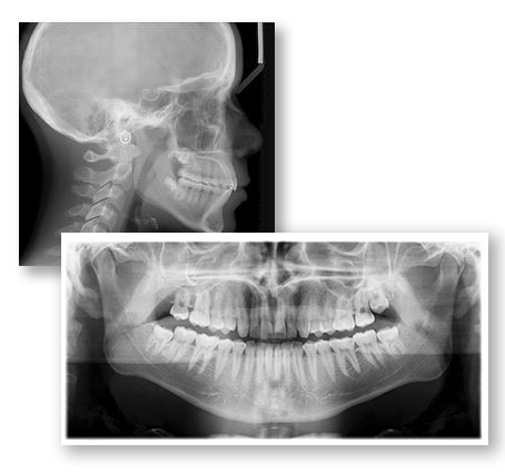 https://www.texasorthodonticsforkids.com/wp-content/uploads/2020/03/dental-cephalometric-xray-image.png